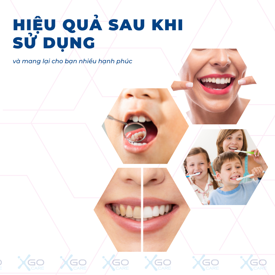Bộ dụng cụ làm sạch răng miệng vệ sinh răng miệng bằng inox 304 chuyên dụng CN014