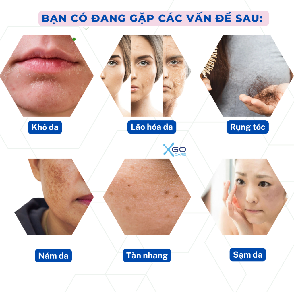 L cystine Phils Lin 500mg viên uống sáng da giảm nám ngăn rụng tóc chống lão hóa giúp móng chắc khỏe hiệu quả hộp 60 vên